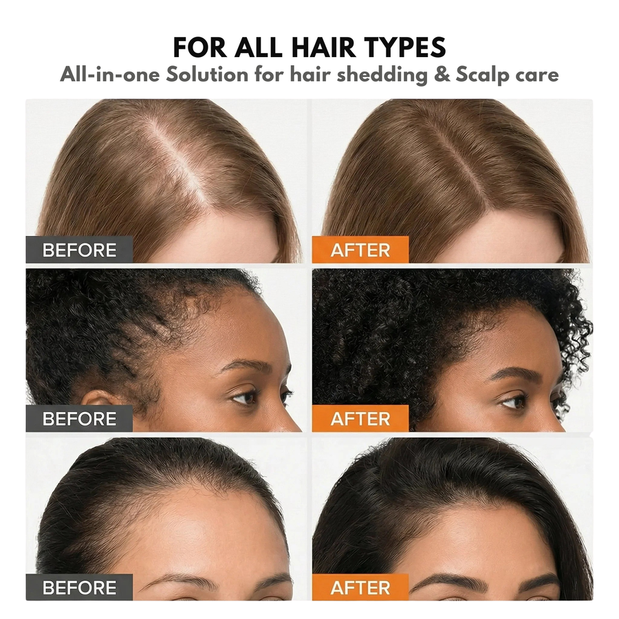 For all hair types — before and after hair regrowth