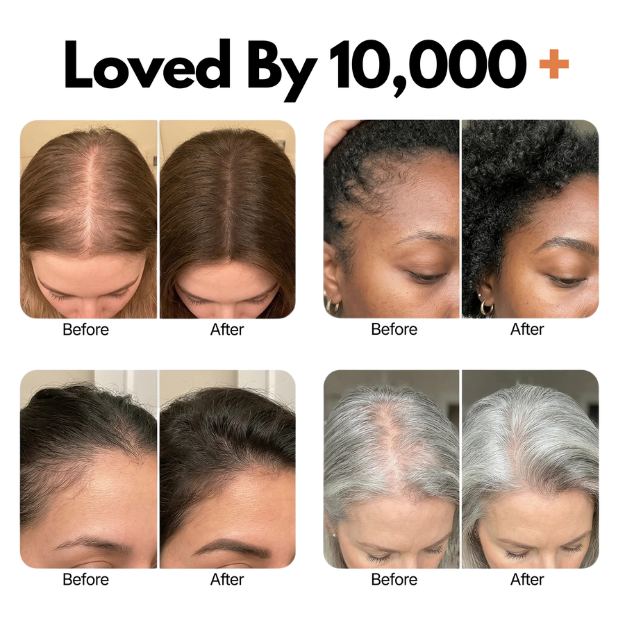 Loved by 10,000+ customers — before and after results